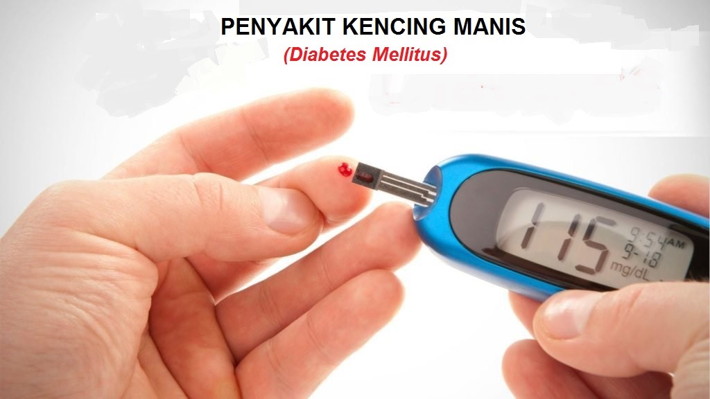 Penyakit Kencing Manis (Diabetes Mellitus)